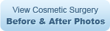 View Cosmetic Surgery Before & After Photos